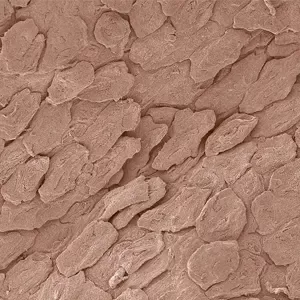Skin Cells Staining Carpet & Upholstery